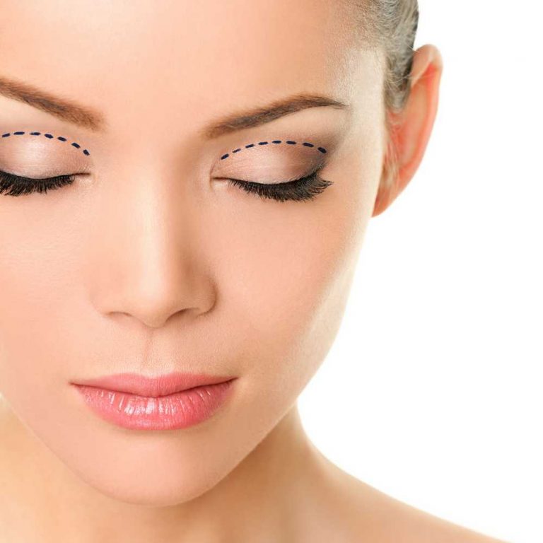 Blepharoplasti 1 1 768x768